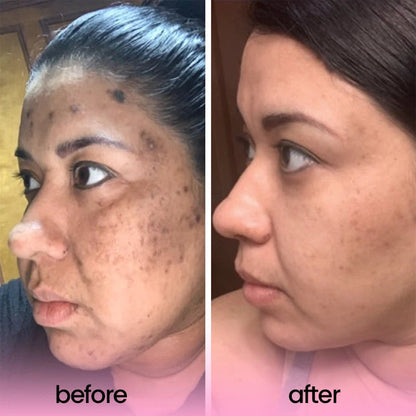 Turmeric and Kojic Acid Cleaning Pads
