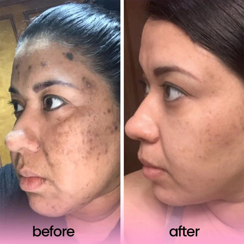 Turmeric and Kojic Acid Cleaning Pads